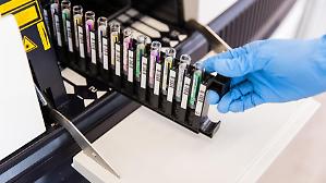 Diasorin, accordo di distribuzione con McKesson in Usa