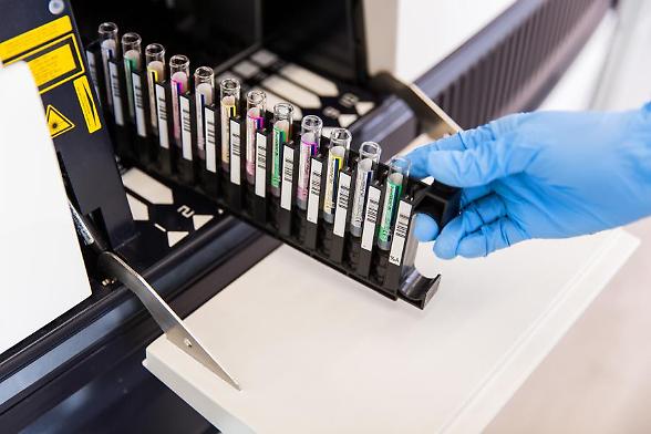 Diasorin, accordo di distribuzione con McKesson in Usa